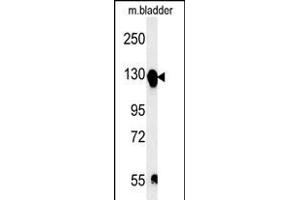 ITGA5 Antibody (C-term) (ABIN651710 and ABIN2840370) western blot analysis in mouse bladder tissue lysates (15 μg/lane). (ITGA5 anticorps  (AA 796-822))