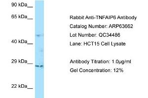Western Blotting (WB) image for anti-Tumor Necrosis Factor-Inducible Protein 6 (TNFAIP6) (C-Term) antibody (ABIN2789586)