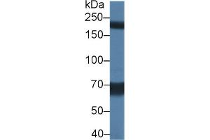 Detection of TRPM7 in Rat Serum using Polyclonal Antibody to Transient Receptor Potential Cation Channel Subfamily M, Member 7 (TRPM7)