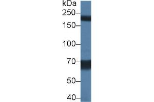Detection of TRPM7 in Rat Serum using Polyclonal Antibody to Transient Receptor Potential Cation Channel Subfamily M, Member 7 (TRPM7) (TRPM7 anticorps  (AA 19-179))