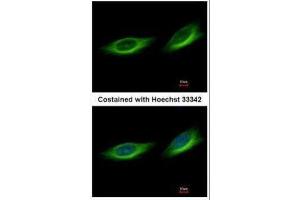 ICC/IF Image Immunofluorescence analysis of methanol-fixed HeLa, using TULP1, antibody at 1:500 dilution. (TULP1 anticorps)