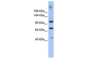 Image no. 1 for anti-Terminal Uridylyl Transferase 1, U6 SnRNA-Specific (TUT1) (AA 253-302) antibody (ABIN6740335) (TUT1 anticorps  (AA 253-302))
