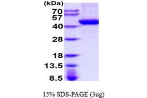 SDS-PAGE (SDS) image for Tyrosylprotein Sulfotransferase 1 (TPST1) (AA 26-370) protein (His tag) (ABIN6387786)
