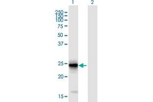 Western Blot analysis of FIBIN expression in transfected 293T cell line ( H00387758-T01 ) by FIBIN MaxPab polyclonal antibody. (FIBIN anticorps  (AA 1-211))