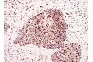 Immunohistochemistry (IHC) image for anti-Complement Component 1, Q Subcomponent Binding Protein (C1QBP) (AA 50-100) antibody (ABIN7454556)