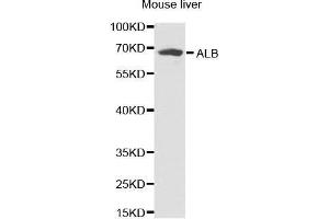 Western Blotting (WB) image for anti-Albumin (ALB) antibody (ABIN3021925) (Albumin anticorps)