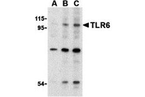 Western Blotting (WB) image for anti-Toll-Like Receptor 6 (TLR6) (N-Term) antibody (ABIN1031623) (TLR6 anticorps  (N-Term))