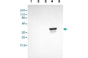 Western blot analysis of Lane 1: RT-4, Lane 2: EFO-21, Lane 3: A-431, Lane 4: Liver, Lane 5: Tonsil with OTC polyclonal antibody  at 1:250-1:500 dilution. (OTC anticorps  (AA 172-299))