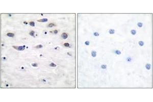 Immunohistochemistry analysis of paraffin-embedded human brain, using GluR1 (Phospho-Ser849) Antibody. (Glutamate Receptor 1 anticorps  (pSer849))