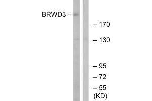 Western blot analysis of extracts from HuvEC, K562, Jurkat and HeLa cells, using HSPA8 antibody. (Hsc70 anticorps  (Internal Region))