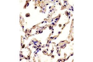 (ABIN390136 and ABIN2840640) staining P12 in human lung tissue sections by Iunohistochemistry (IHC-P - paraformaldehyde-fixed, paraffin-embedded sections). (MMP12 anticorps  (C-Term))