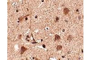 Immunohistochemistry (IHC) image for anti-SLIT and NTRK-Like Family, Member 5 (SLITRK5) (Middle Region 2) antibody (ABIN1031202) (SLITRK5 anticorps  (Middle Region 2))