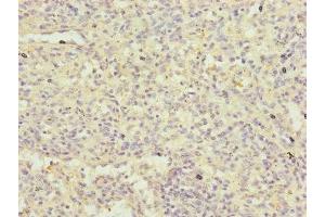 Immunohistochemistry of paraffin-embedded human spleen tissue using ABIN7152485 at dilution of 1:100 (FBXL5 anticorps  (AA 1-310))