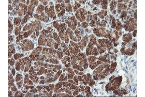 Image no. 3 for anti-Myeloid Leukemia Factor 1 (MLF1) antibody (ABIN1499493)