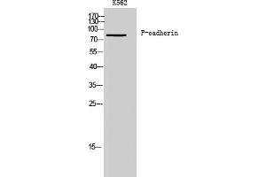 Western Blot analysis of K562 cells using P-cadherin Polyclonal Antibody.