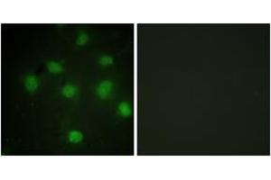 Immunofluorescence analysis of COS7 cells, using TLK1 (Ab-764) Antibody. (TLK1 anticorps  (AA 730-779))