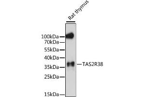 Western blot analysis of extracts of rat thymus, using TR38 antibody (ABIN7270736) at 1:1000 dilution.