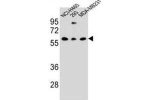 Western Blotting (WB) image for anti-C-Type Lectin Domain Family 17, Member A (CLEC17A) antibody (ABIN3000135) (CLEC17A anticorps)