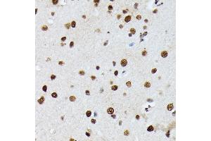 Immunohistochemistry of paraffin-embedded rat brain using hnRNPM antibody (ABIN6128031, ABIN6141919, ABIN6141920 and ABIN6222681) at dilution of 1:100 (40x lens).
