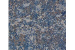 Used in DAB staining on fromalin fixed paraffin- embedded spleen tissue