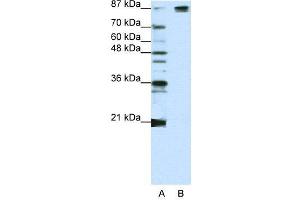 WB Suggested Anti-SF3B1  Antibody Titration: 1. (SF3B1 anticorps  (Middle Region))