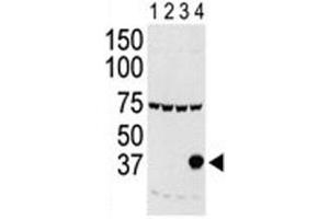 Western blot testing of Aurora-C antibody and lysate of 293 cells expressing 1) Flag tag, 2) Flag-tagged -A, 3) -B and 4) Aurora-C. (Aurora Kinase C anticorps  (AA 1-30))