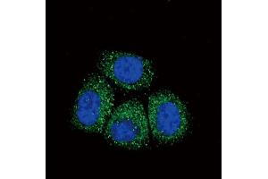 Confocal immunofluorescent analysis of SCNN1A Antibody (Center) (ABIN652752 and ABIN2842496) with Hela cell followed by Alexa Fluor?