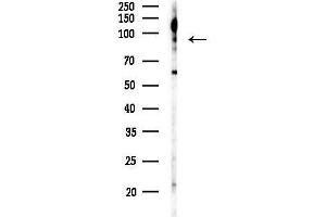 anti-Leukocyte Receptor tyrosine Kinase (LTK) (Internal Region) antibody