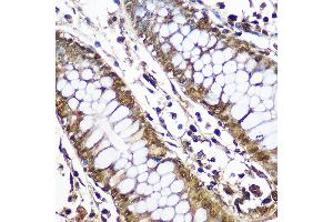 Immunohistochemistry of paraffin-embedded Human colon using CNOT7 Rabbit pAb (ABIN6127563, ABIN6138783, ABIN6138784 and ABIN6224834) at dilution of 1:50 (40x lens).