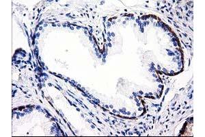 Immunohistochemical staining of paraffin-embedded Human Kidney tissue using anti-ALDH1L1 mouse monoclonal antibody. (ALDH1L1 anticorps)