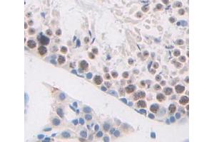 Used in DAB staining on fromalin fixed paraffin- embedded testis tissue