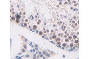 Used in DAB staining on fromalin fixed paraffin- embedded testis tissue (HMGB4 anticorps  (AA 25-167))