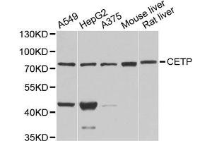 Western blot analysis of extracts of various cell lines, using CETP antibody.