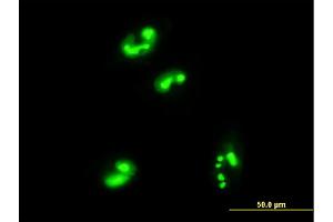 Immunofluorescence of monoclonal antibody to C1orf33 on HepG2 cell. (C1orf33 anticorps  (AA 1-239))