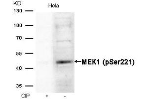 Western blot analysis of extracts from Hela cells, treated with calf intestinal phosphatase (CIP), using MEK1 (Phospho-Ser221) Antibody.