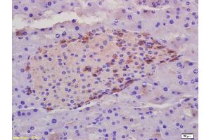 Formalin-fixed and paraffin embedded rat placenta labeled with Rabbit Anti phospho-ZCWCC1 (Ser739) Polyclonal Antibody, Unconjugated (ABIN1385133) at 1:200 followed by conjugation to the secondary antibody and DAB staining