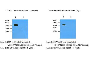 Western Blotting (WB) image for anti-Herpes Virus Type 8 (HHV8) (AA 122-329) antibody (ABIN371871) (HHV8 anticorps  (AA 122-329))