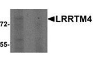 Western blot analysis of LRRTM4 in HeLa cell lysate with LRRTM4 antibody at 1 μg/ml in (left) the absence and (right) the presence of blocking peptide. (LRRTM4 anticorps  (Center))