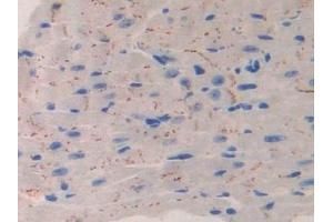 Detection of IL11Ra in Mouse Heart Tissue using Polyclonal Antibody to Interleukin 11 Receptor Alpha (IL11Ra) (IL11RA anticorps  (AA 59-217))