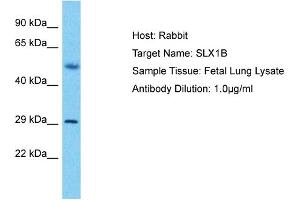 Host: Rabbit Target Name: SLX1B Sample Type: Fetal Lung lysates Antibody Dilution: 1.