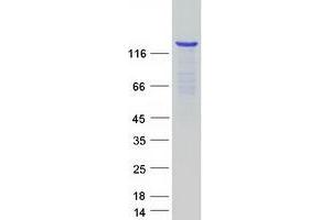 Validation with Western Blot
