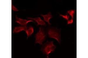 ABIN6275598 staining COLO205 by IF/ICC.