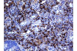 Image no. 9 for anti-Selenium Binding Protein 1 (SELENBP1) antibody (ABIN1500860)