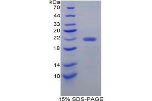 SDS-PAGE analysis of Mouse Ficolin 2 Protein. (Ficolin 2 Protéine)
