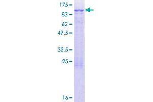 Image no. 1 for Coiled-Coil Domain Containing 40 (CCDC40) (AA 1-478) protein (GST tag) (ABIN1348292)