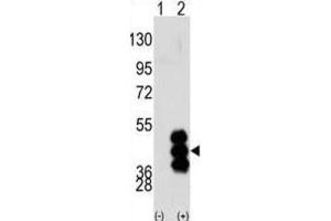 Western Blotting (WB) image for anti-phosphorylase Kinase, gamma 2 (Testis) (PHKG2) antibody (ABIN3003064) (PHKG2 anticorps)