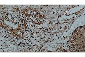 Immunohistochemistry of paraffin-embedded Human colon using Galectin 3 Monoclonal Antibody at dilution of 1:50.