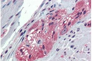 Anti-TXLNB antibody  ABIN1049448 IHC staining of human colon, ganglion cells. (Taxilin beta anticorps  (Internal Region))