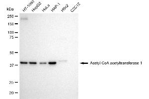 Western blotting analysis using Acetyl-CoA acetyltransferase 1 antibody (ABIN7797439).