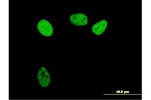 Immunofluorescence of purified MaxPab antibody to RPA1 on HeLa cell. (RPA1 anticorps  (AA 1-616))